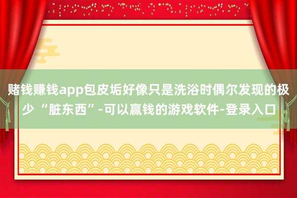 赌钱赚钱app包皮垢好像只是洗浴时偶尔发现的极少 “脏东西”-可以赢钱的游戏软件-登录入口